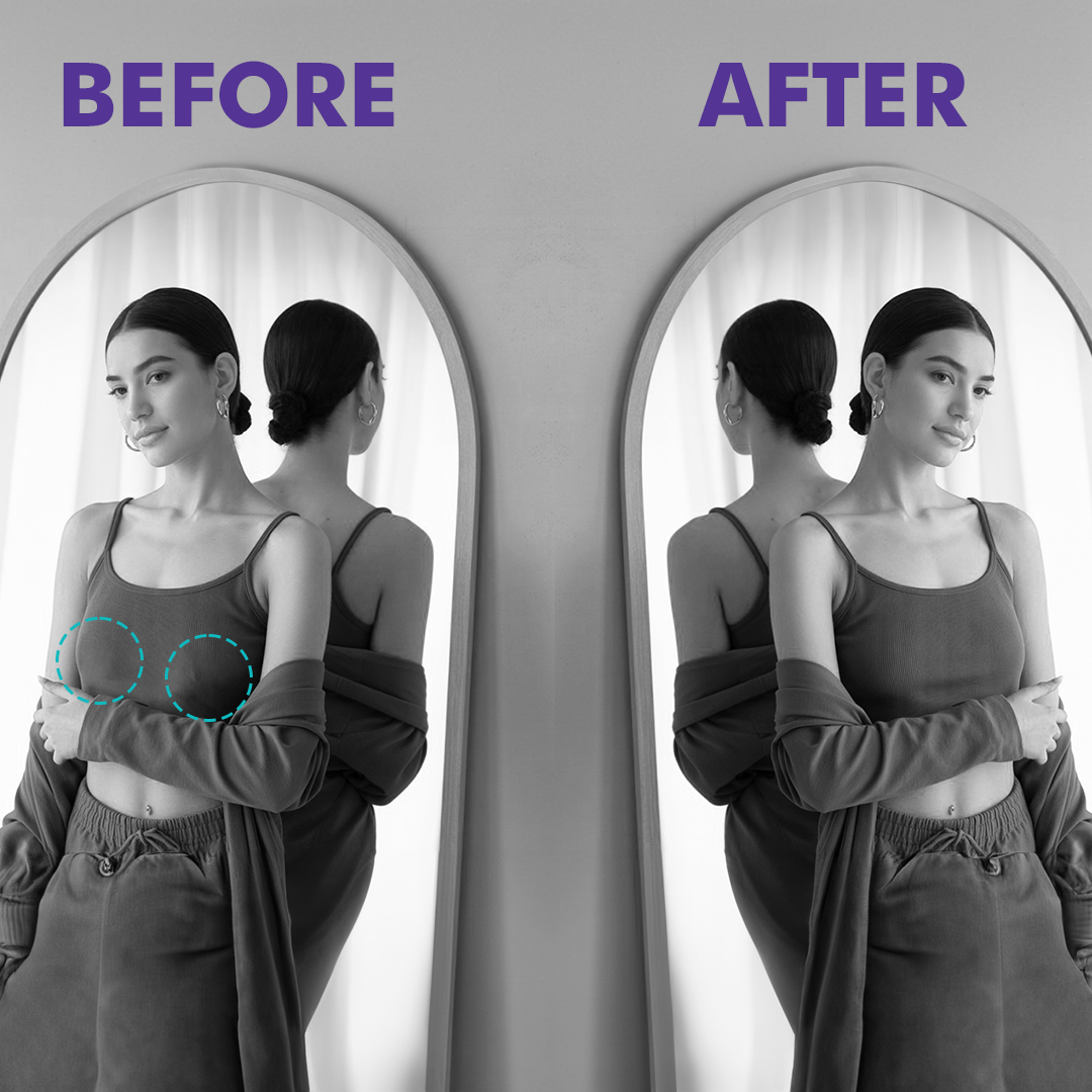 Breast Cups X Lift Tape